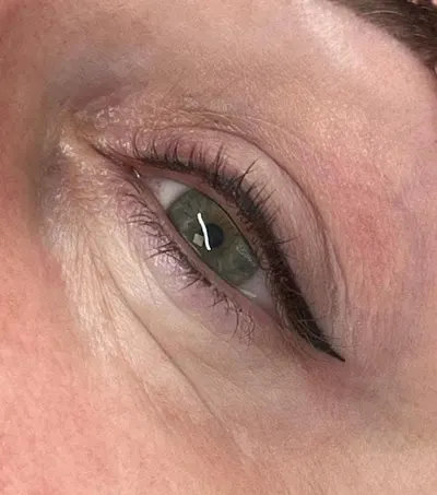 Rosa Med Anna Struska